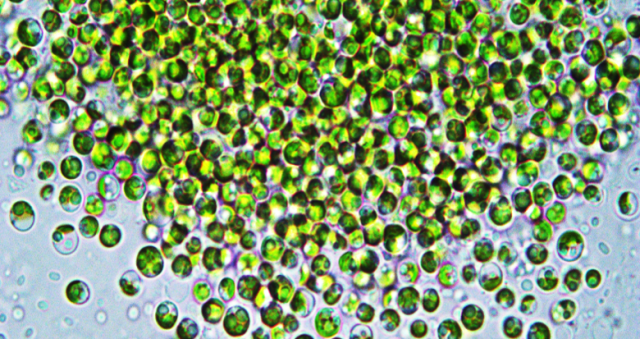 Chlorella Vulgaris as seen under the microscope