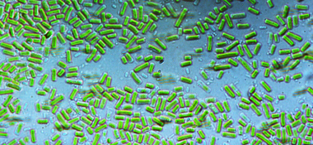 Stichococcus sp. as seem under the microscope
